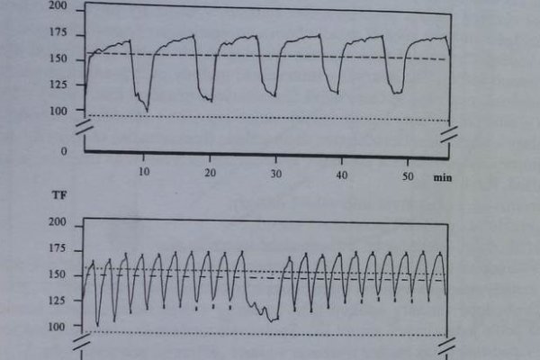Obrázok 1 - Príklady variantov intervalového tréningu podľa tepovej frekvencie